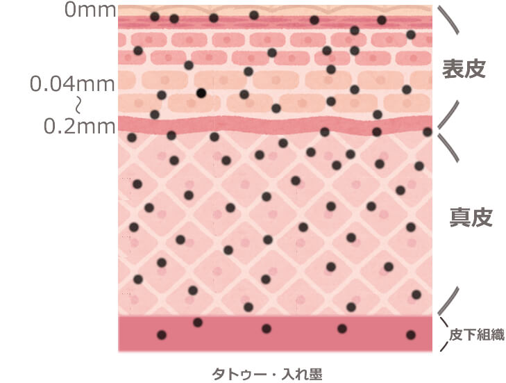 アートメイクとタトゥーの色素沈着のちがい